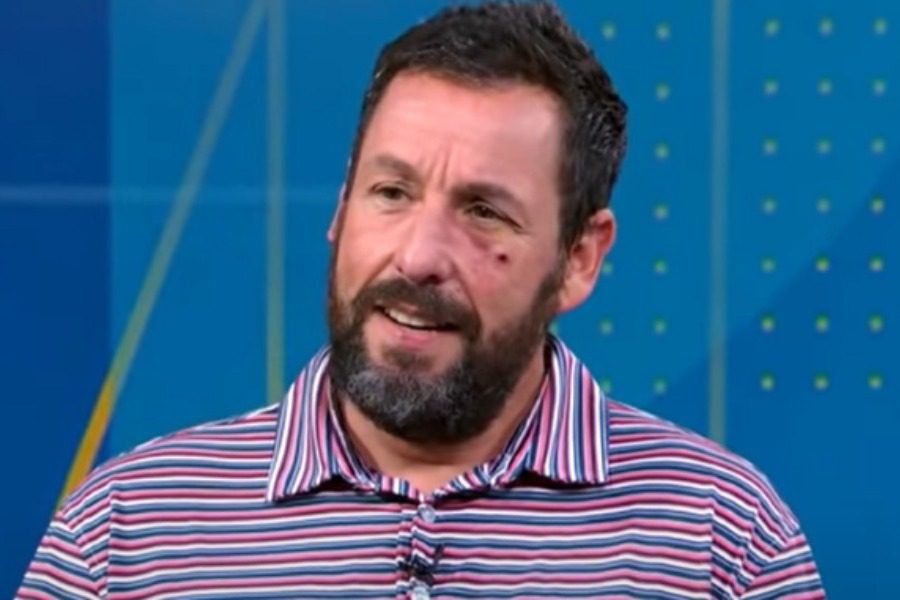 Adam Sandler: Το μαυρισμένο μάτι σε συνέντευξη και η καθόλου cool εξήγηση που έδωσε