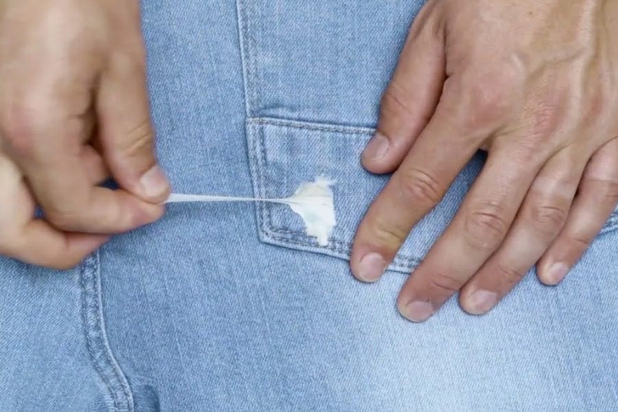 Πώς να βγάλετε την κολλημένη τσίχλα από τα ρούχα σας 