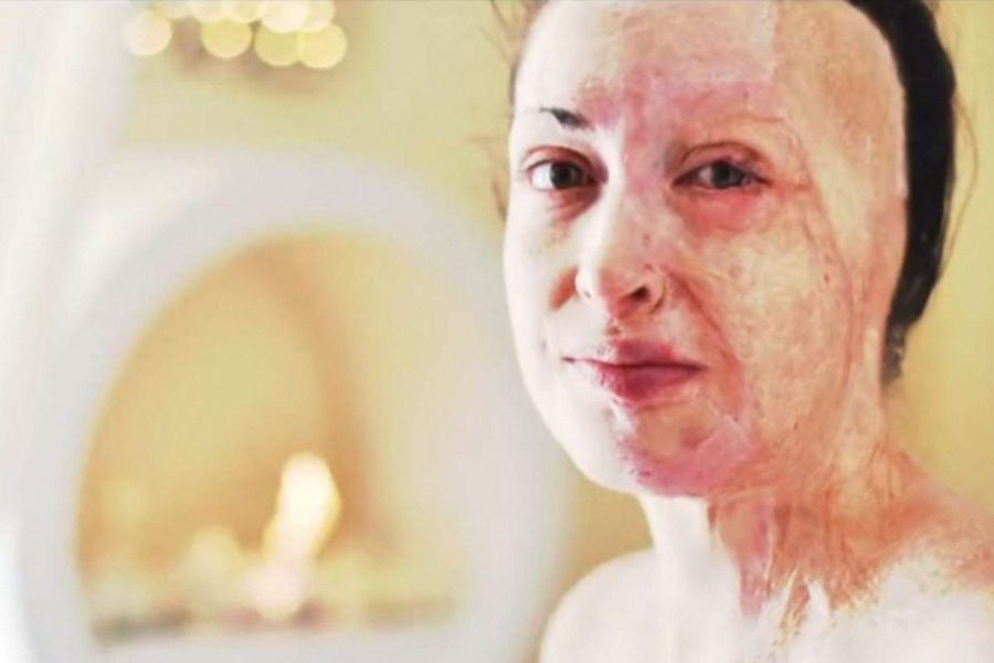 Ιωάννα Παλιοσπύρου: Έδειξε το πρόσωπό της και περιέγραψε τις δραματικές στιγμές της επίθεσης με βιτριόλι