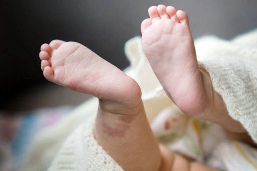 Γονείς έχασαν προσωρινά την κηδεμονία του μωρού επειδή ζητούσαν «ανεμβολίαστο αίμα» για να κάνει επέμβαση
