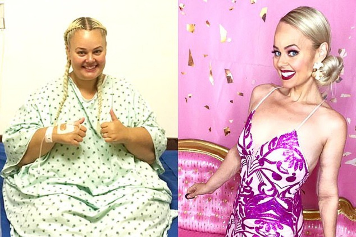Έχασε 92 κιλά και έγινε αγνώριστη όταν απέκτησε εμμονή με τη Barbie