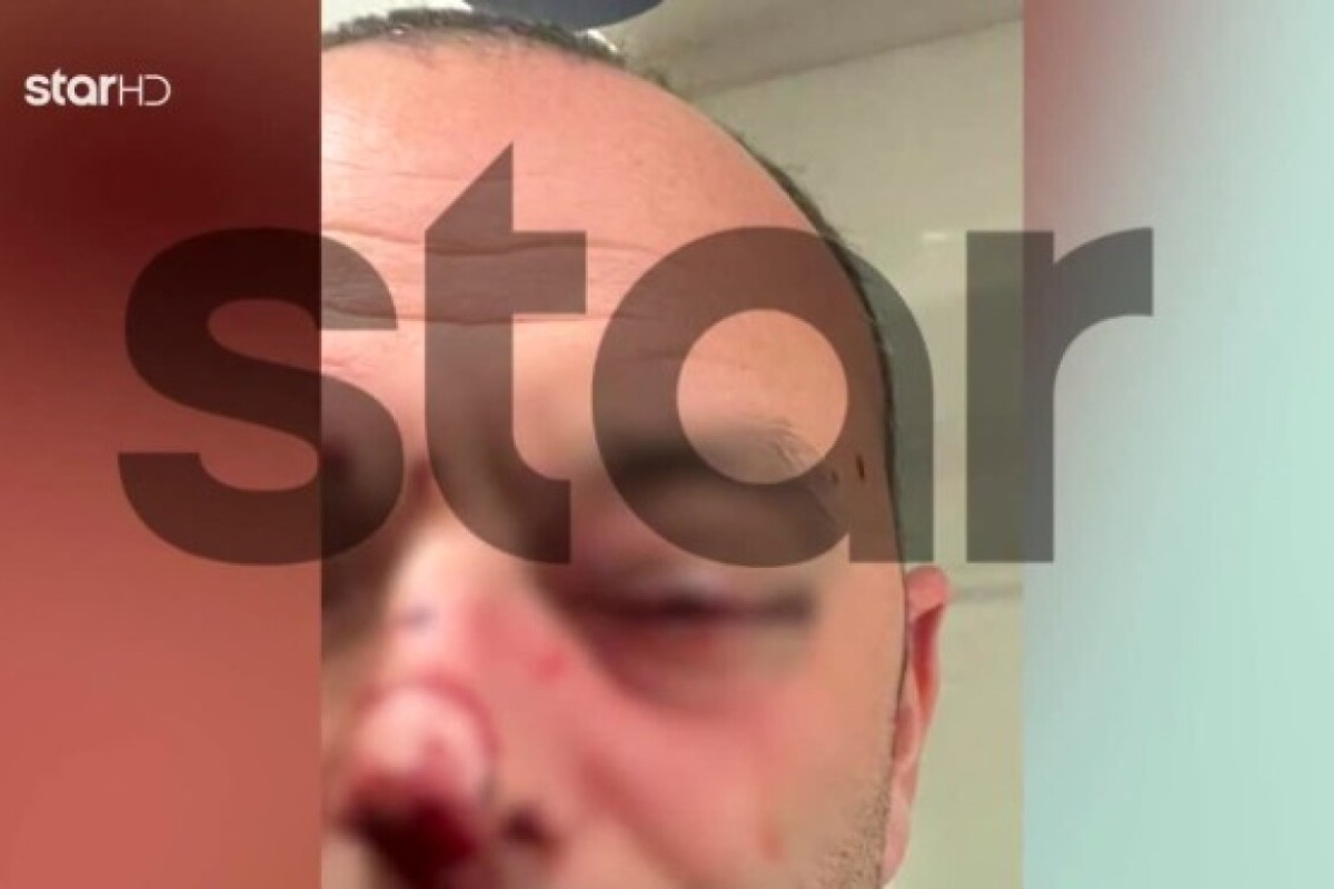 Τρίκαλα: Βίντεο από τον άγριο ξυλοδαρμό γνωστού δικηγόρου από ανηλίκους