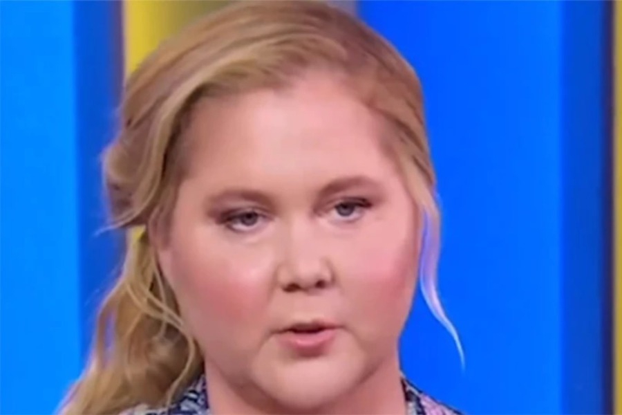 Η Έιμι Σούμερ απαντά στα σχόλια για το «πρησμένο πρόσωπό της»