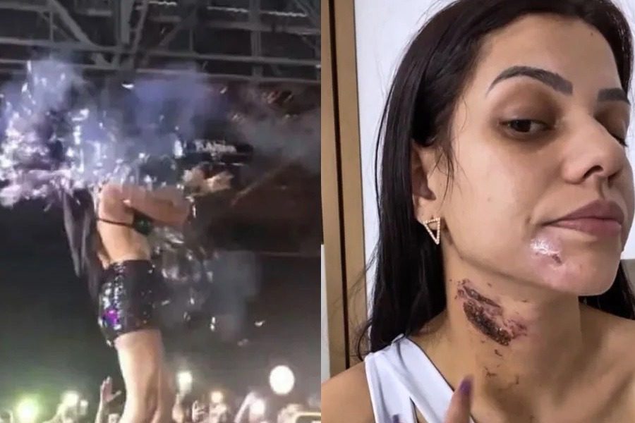 Βραζιλία: DJ τραυματίστηκε από «όπλο» με κομφετί ‑ Έπαθε εγκαύματα πρώτου βαθμού