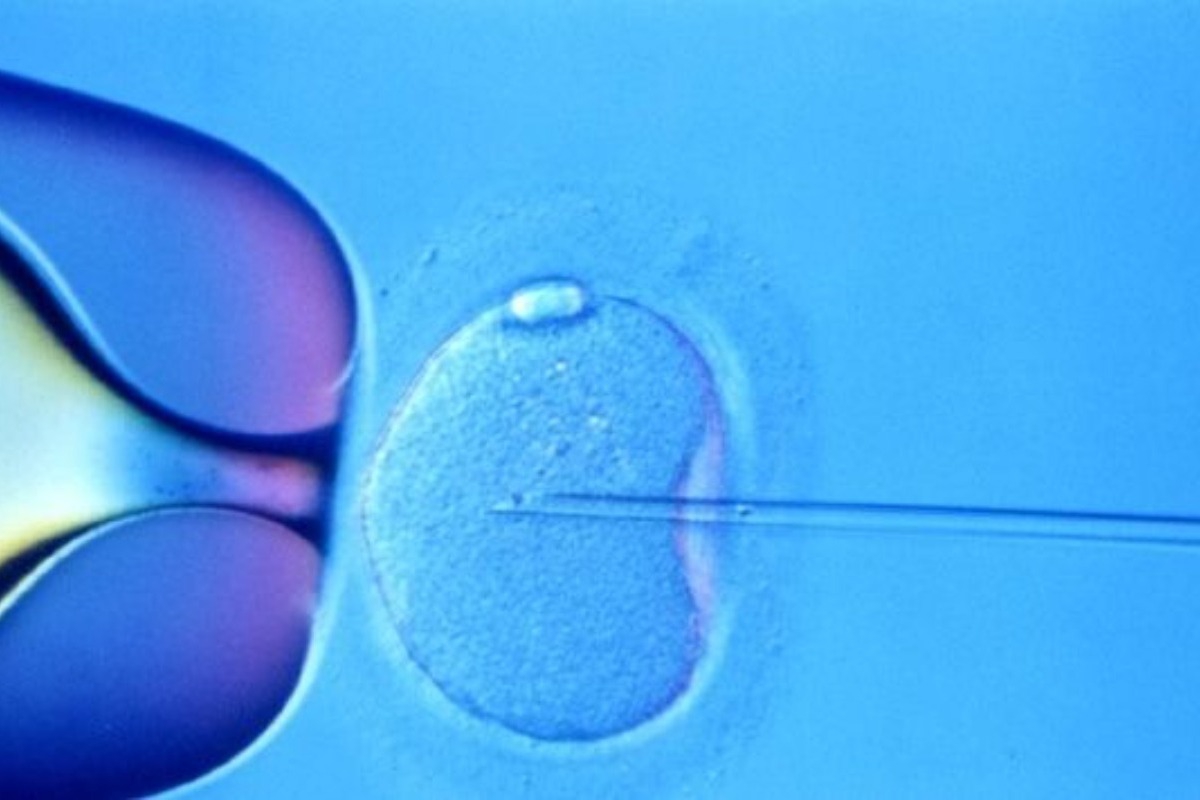 Πρώτες γεννήσεις βρεφών με DNA από τρεις ανθρώπους