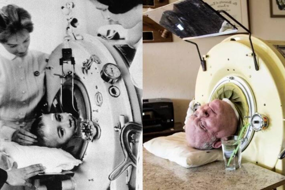 Ο άνδρας που ζει 70 χρόνια σε μεταλλική συσκευή αναπνοής