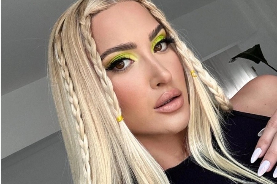 Ιωάννα Τούνη: Αγνώριστη μετά από την επέμβαση στη μύτη, πρησμένη και με μώλωπες