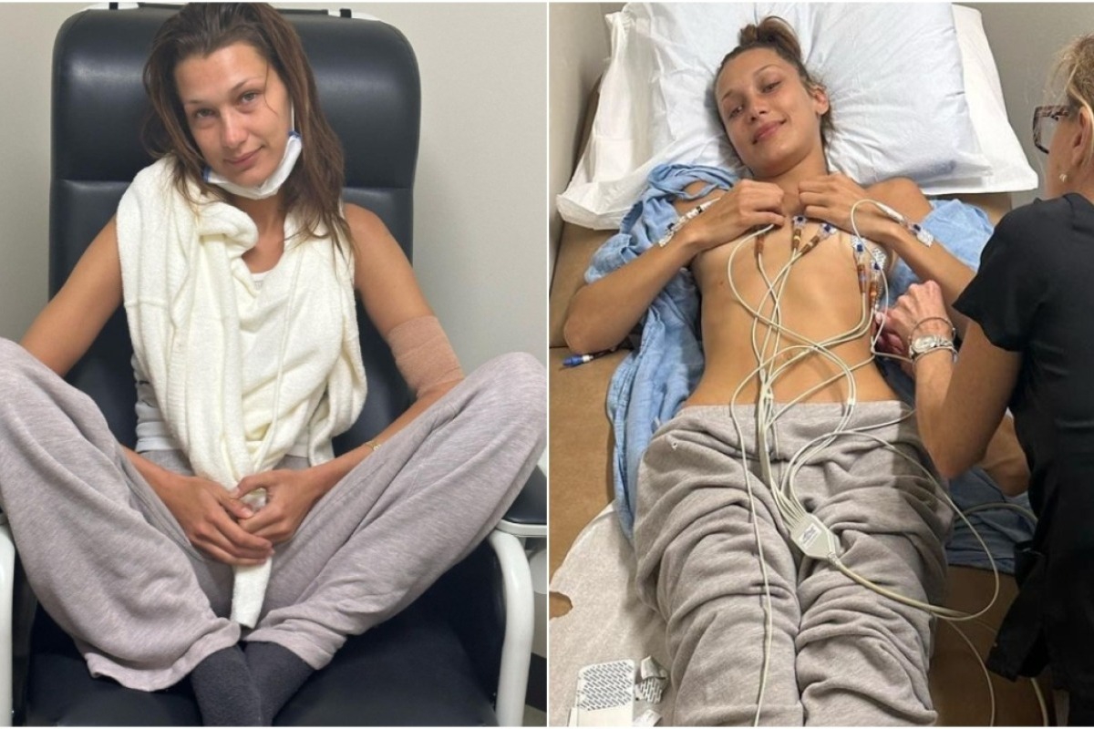 Μπέλα Χαντίντ: Καταβεβλημένη και με σωληνάκια στις φωτογραφίες από την περίοδο της θεραπείας της