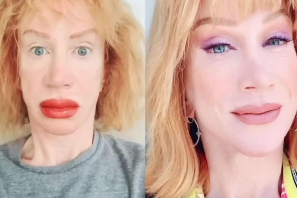 Κάθι Γκρίφιν: Σοκάρει με τα πρησμένα χείλη η ηθοποιός μετά από επέμβαση τατουάζ