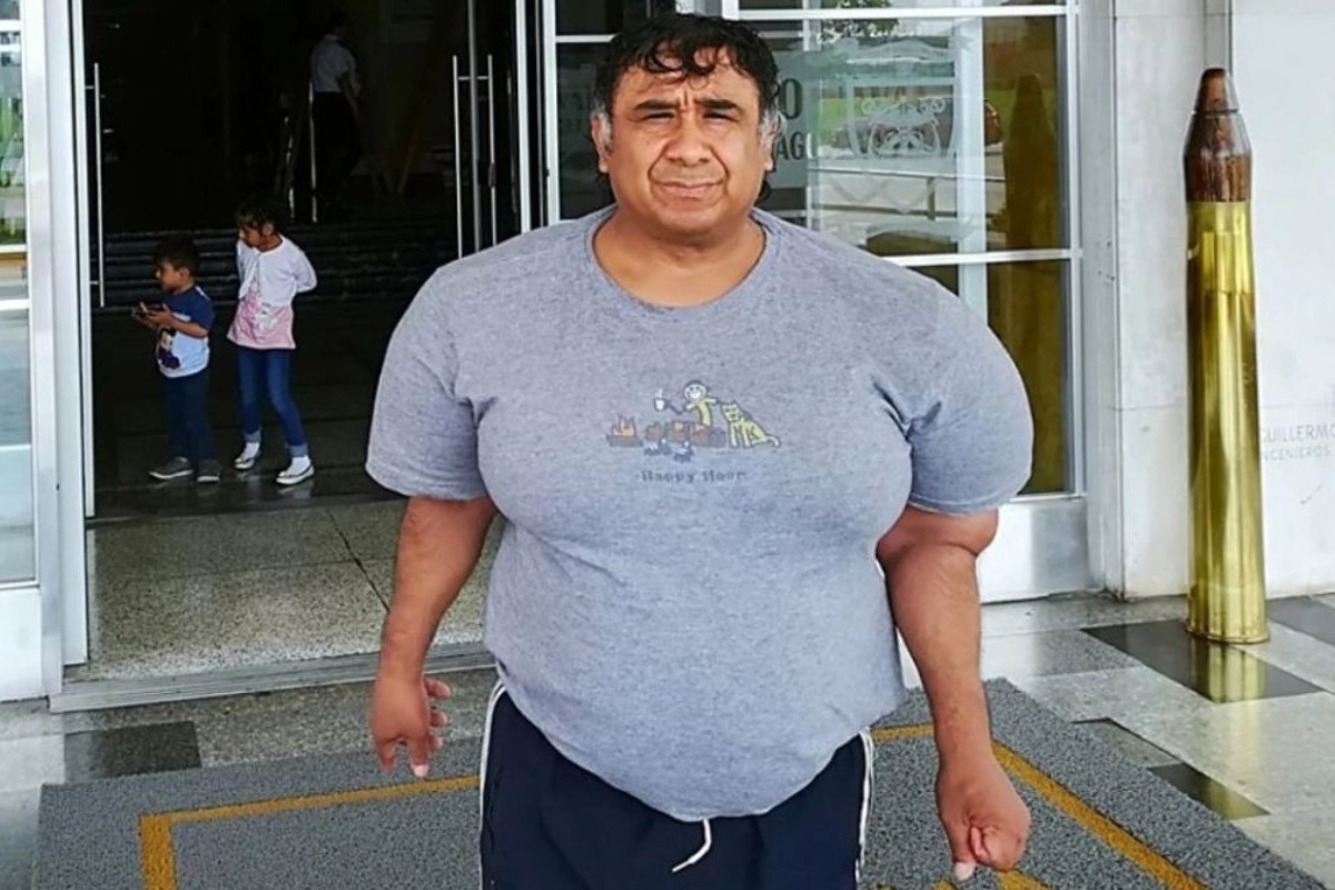 Περού: Δύτης έχει «φυσαλίδες αζώτου» στο σώμα εδώ και 11 χρόνια – «Ζω σαν φουσκωμένο μπαλόνι» - «Ζω σαν φουσκωμένο μπαλόνι και περιμένω μία λύση», αποκαλύπτει ο Αλεχάντρο Ράμος Μαρτίνες