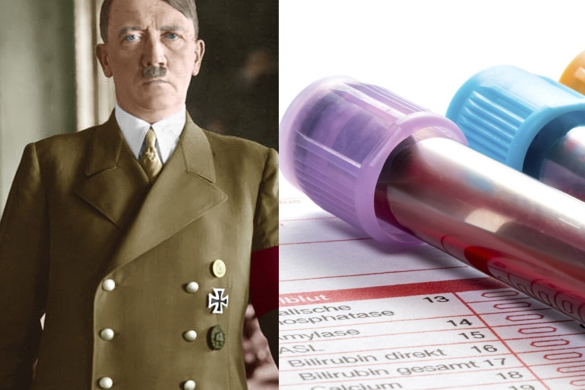 Το αίμα του Χίτλερ μιλά: Τι έδειξαν τα ευρήματα για τα γεννητικά του όργανα και την ψυχική του υγεία