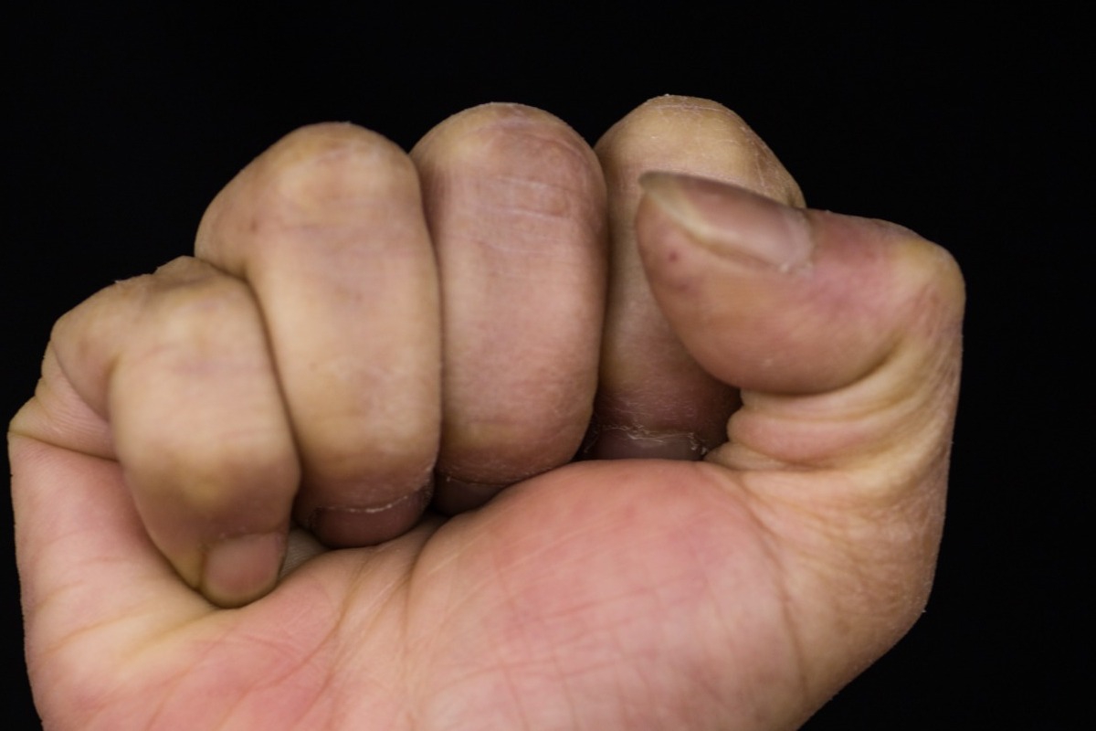 Θεσσαλονίκη: Επιτέθηκαν σε 13χρονο γιατί τους ενοχλούσε το τύμπανο κατά τη διάρκεια αγώνα