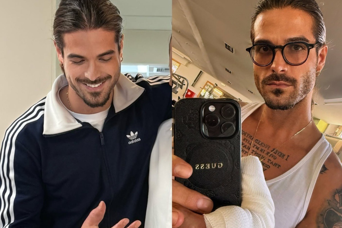 Αρης Μουγκοπέτρος: Δείχνει για πρώτη φορά τα δύο πρόσθετα δάχτυλα μετά τον ακρωτηριασμό του