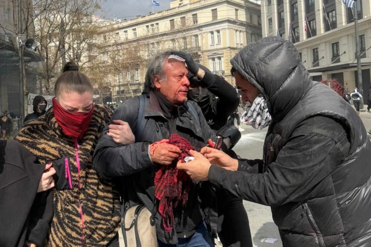 Τέμπη - Επεισόδια στην Αθήνα: Τραυματίστηκε ο φωτορεπόρτερ Ορέστης Παναγιώτου - Τραυματίστηκε στο κεφάλι από χειροβομβίδα κρότου λάμψης