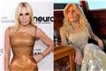 Donatella Versace: Τεράστια αλλαγή - Σοκάρουν οι φωτογραφίες μετά τις νέες πλαστικές