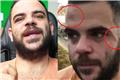 Ο Youtuber Teosty για τον ξυλοδαρμό του στα Γιάννενα: Δείχνω τα σημάδια για να καταλάβουμε ότι η βία είναι πραγματική
