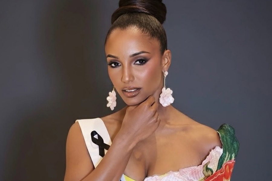 Με εγκεφαλική αιμορραγία η Μις Τζαμάικα ‑ Δίνει μάχη για τη ζωή της