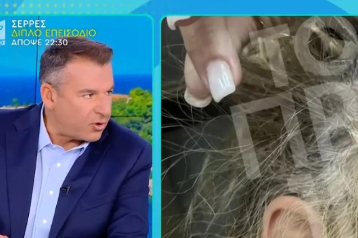 Γνωστός πλαστικός χειρουργός ξυλοκόπησε στη μέση του δρόμου 43χρονη