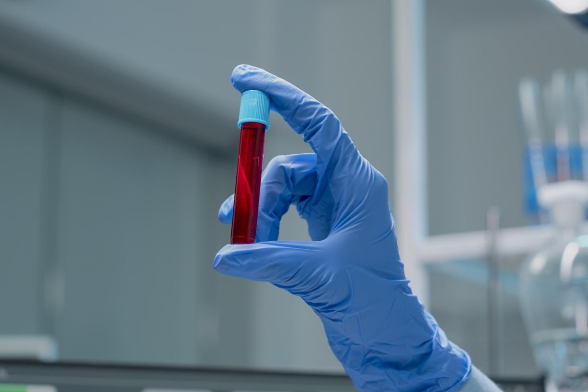 Σήμερα έμαθα: Η ομάδα αίματος που έχουν μόνο 50 άνθρωποι στον πλανήτη