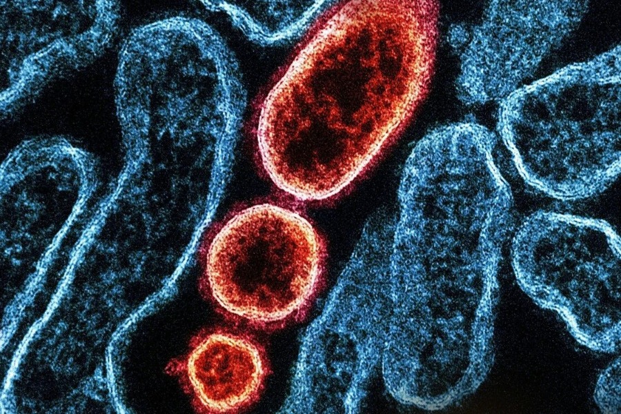 Ιός Nipah: Έχει θνησιμότητα 40 με 50 τοις εκατό - Ποιες οι πιθανότητες να φτάσει στην Ελλάδα - Πώς μεταδίδεται; - Όλα όσα γνωρίζουμε για τον ιό που ανησυχεί τις υγειονομικές αρχές στις ασιατικές χώρες