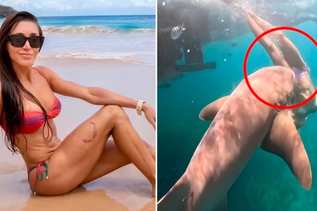 Βραζιλία: Καρέ‑καρέ η στιγμή που καρχαρίας αρπάζει από το πόδι τουρίστρια μόλις βουτά στη θάλασσα, δείτε βίντεο