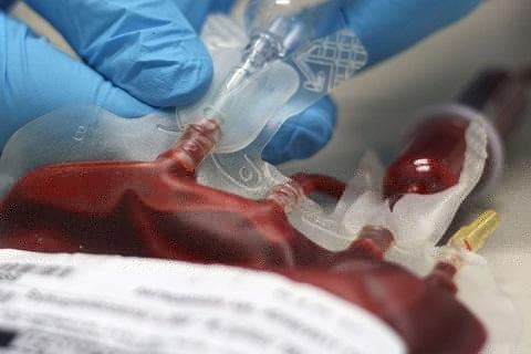 Έκκληση για αίμα για τα δίδυμα που παρέσυρε ο μοτοσυκλετιστής